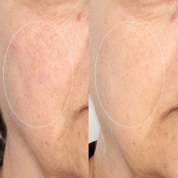 PERRICONE MD High Potency Intensive Smoothing Serum - Picture 3 of 9